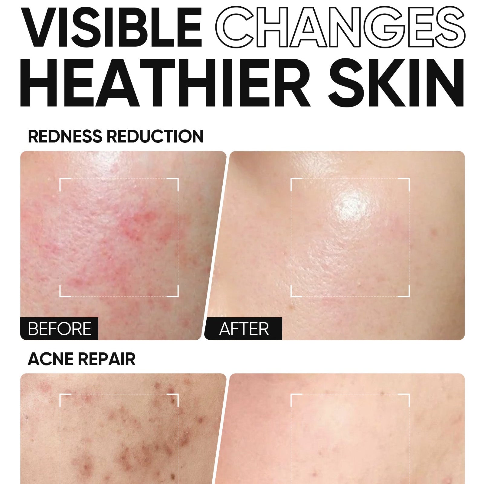 Day & Night Cream Duo - Glow Bright Day Cream & 5X Ceramide Barrier Repair Moisture Gel