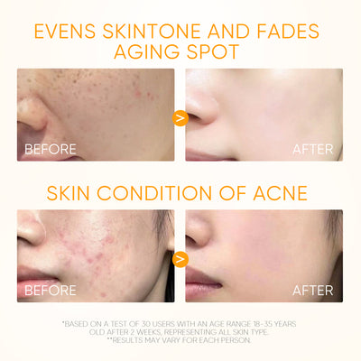 10% Vitamin C Glow Serum Brighten Dark Spots & Even Skin Tone