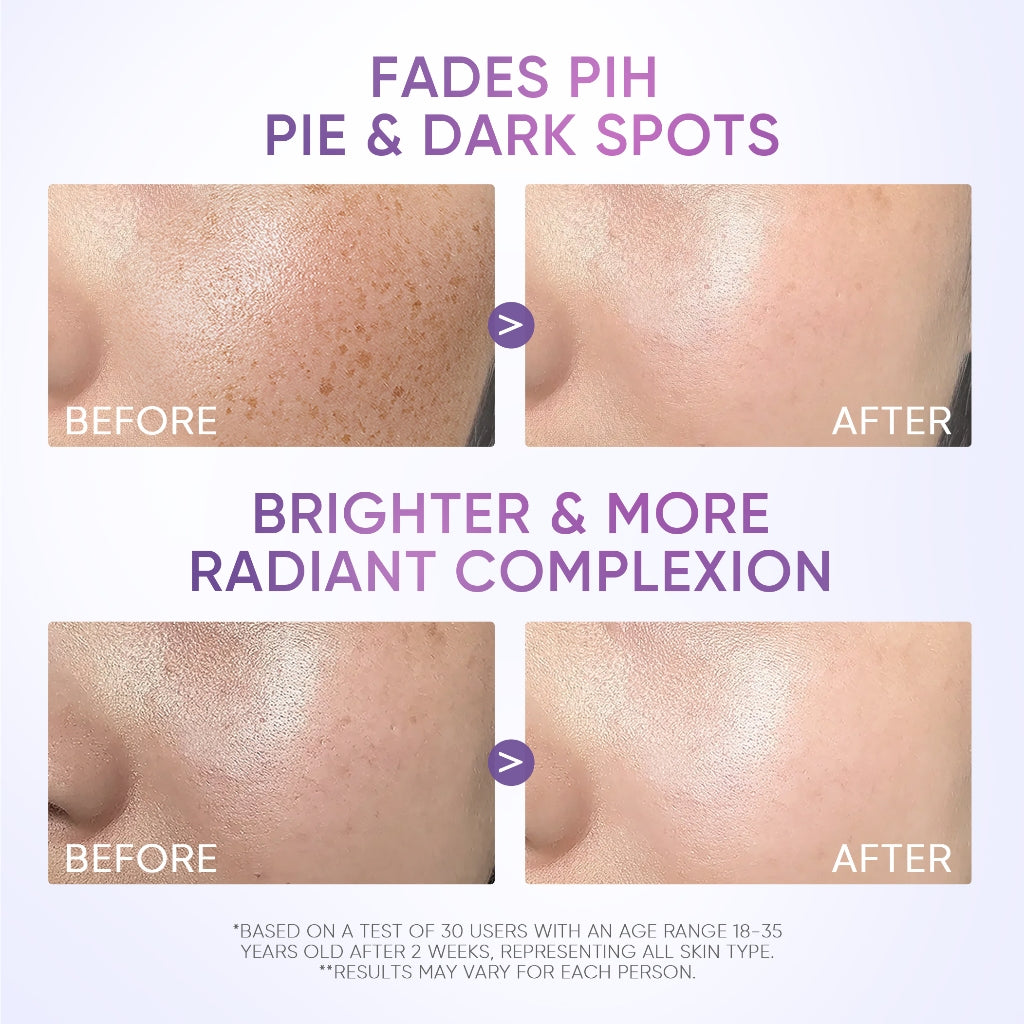 SymWhite 377 Dark Spot Moisture Gel