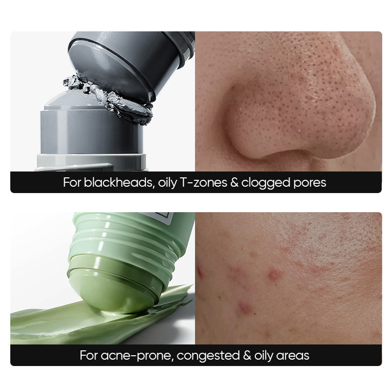 #Color_Acne Care + Blackhead Control