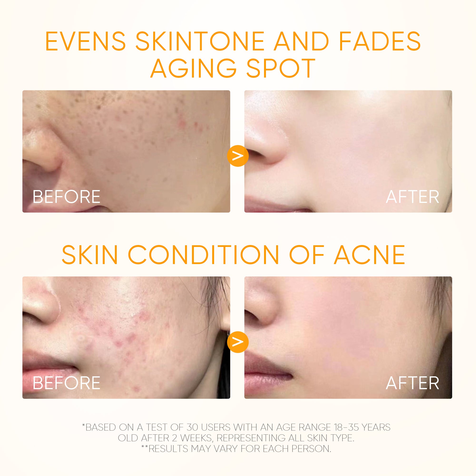 10% Vitamin C Glow Serum Brighten Dark Spots & Even Skin Tone