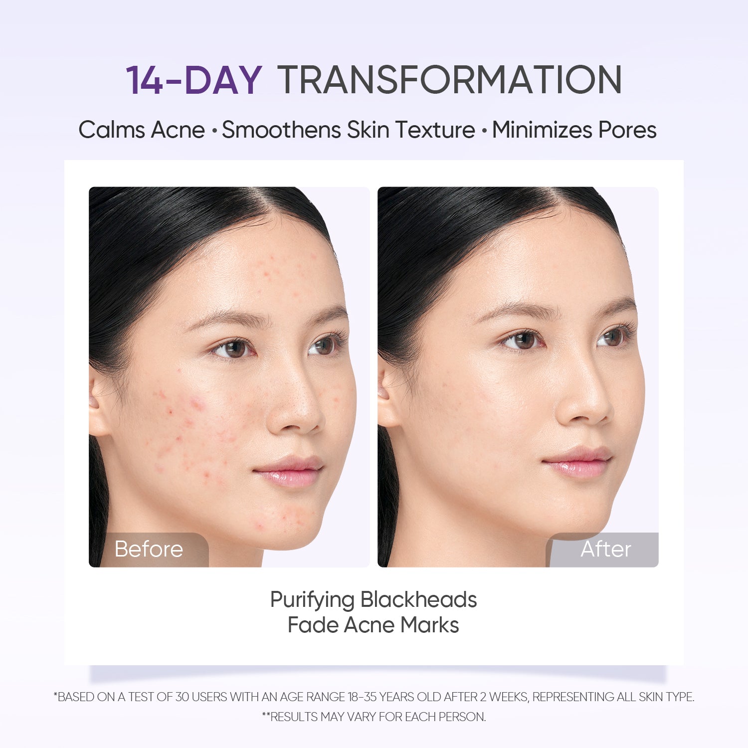 Lactic Acid Exfoliating Serum Smooth & Bright Skin