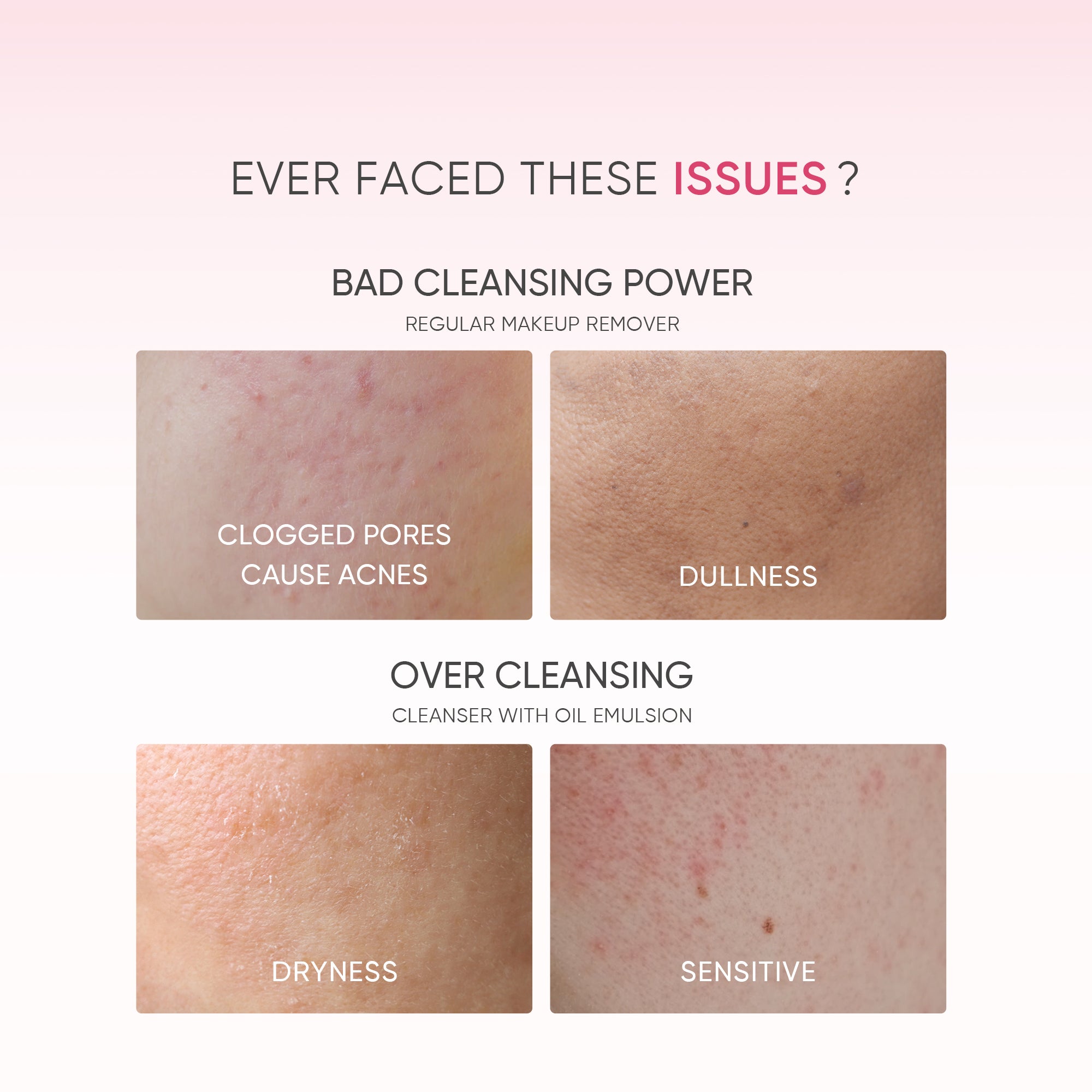 Zero Oil Cleansing Balm Makeup Remover