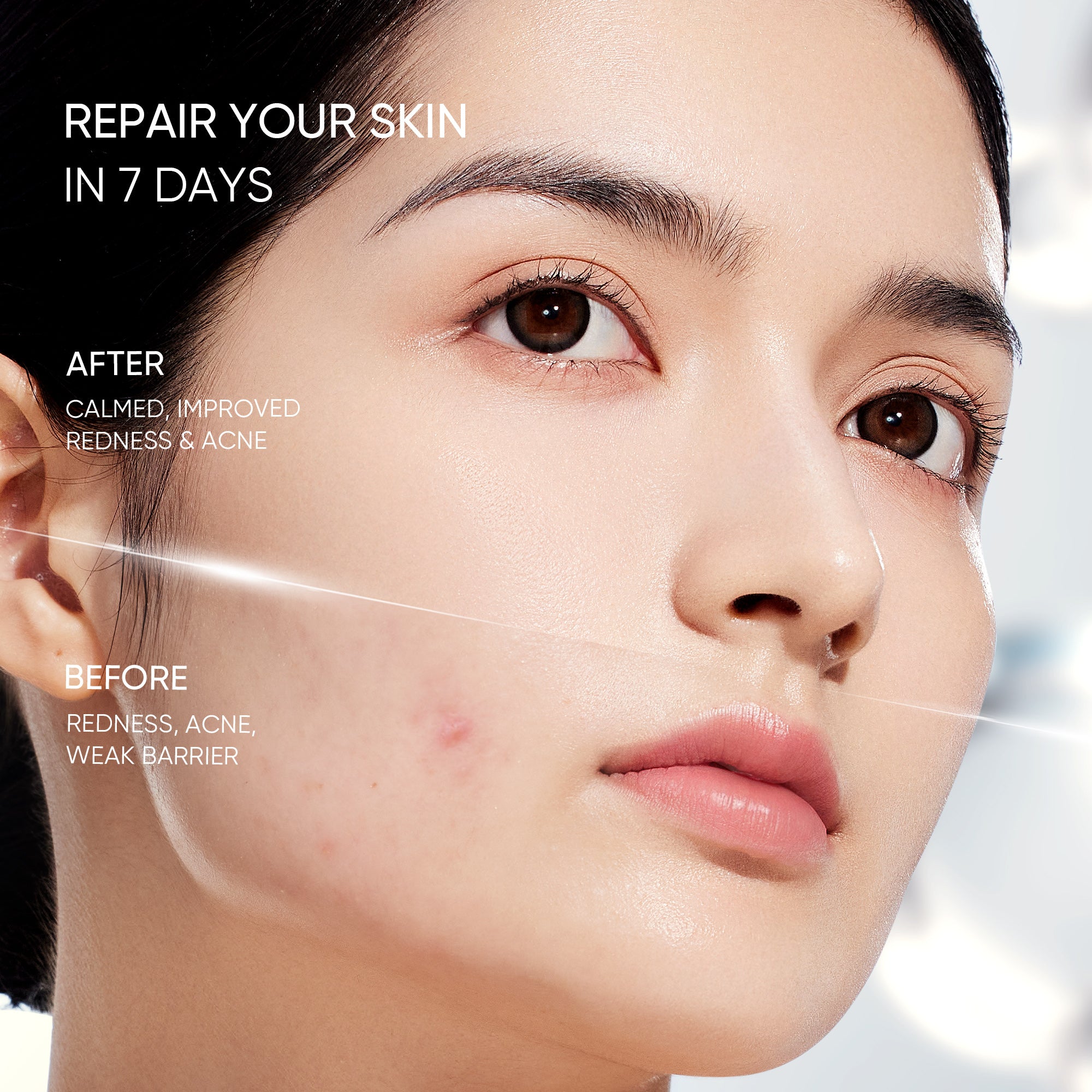 Sensitive Skin Hydration Moisture Gel